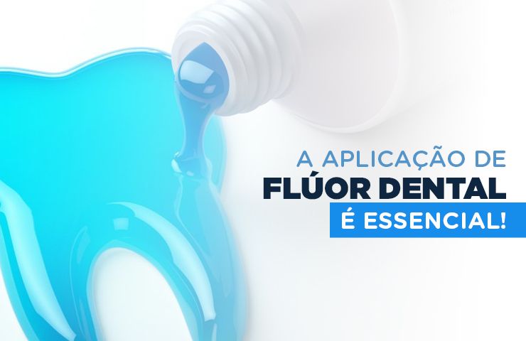 A aplicação de Flúor dental é essencial! 