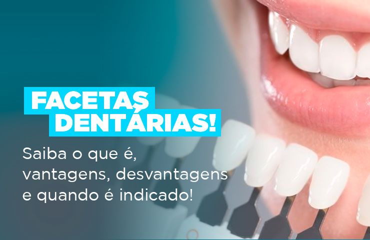 Facetas dentárias - saiba o que é, vantagens, desvantagens e quando é indicado!